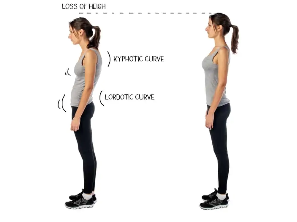 woman demonstrating slouched posture and correct posture to supplement an article about easy ways to improve your posture
